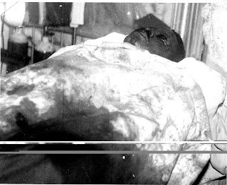 Image of Dele Giwa's death